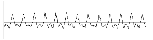時(shí)域波形有時(shí)會出現(xiàn)單邊截?cái)喱F(xiàn)象